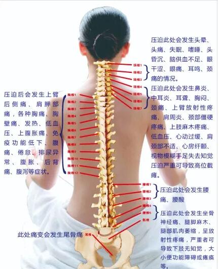 保護(hù)腰椎—示范腰椎保健操，趕快收藏吧