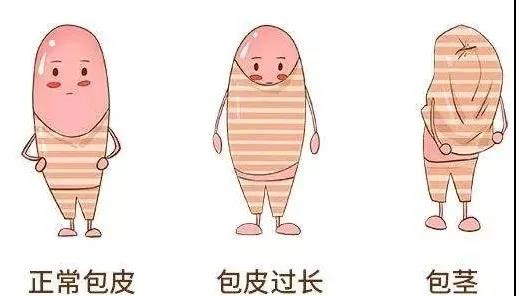 【保山安利醫(yī)院】家長(zhǎng)速看！暑期包皮手術(shù)預(yù)約正當(dāng)時(shí)！